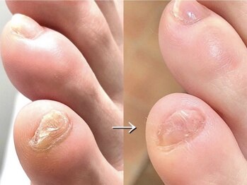 リノ プレミアム(Lino Premium)/