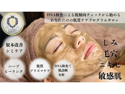 ラビエス(LAVIES)の写真