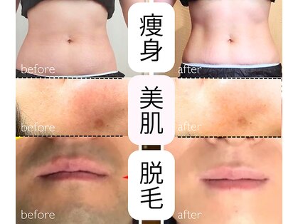 ファインボディ(Fine Body)の写真