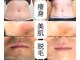 ファインボディ(Fine Body)の写真