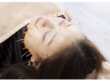 埼玉所沢美容鍼灸院ハリナチュレ【小顔矯正/美容鍼】【8/8 NEW OPEN (予定)】の雰囲気(プライベート空間で美容鍼&小顔矯正【リフトアップ/むくみ】)