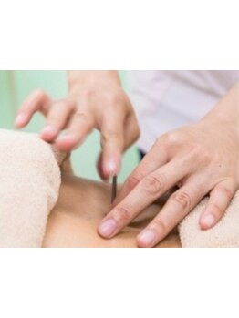 鍼灸施術を受けたい