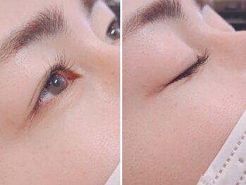 アイラッシュマルヴァ(Eye Lash Malva)/