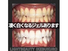 ライトビューティー 池袋店(LightBeauty)/症例写真