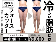 カリスボーテ 関本店の雰囲気（夏はもうすぐ！足痩足ならフォースカッター2回コースがおすすめ）