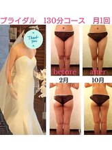 バービーホリック(barbie holic)/２０代　ブライダルエステ　