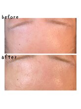 ニコリ(nicori)/ツヤッツヤ♪