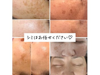 ベリッシマ(Bellissima)