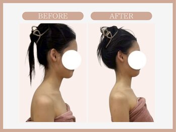 アコガレコガオ 青森店/