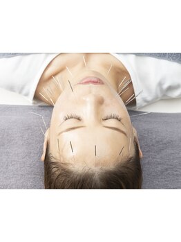 鍼灸施術を受けたい