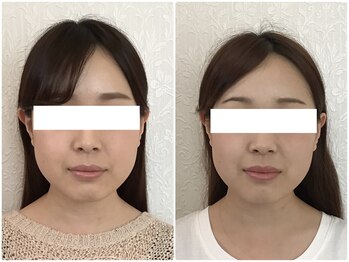 美容整体 ウェリナ 蟹江院/小顔矯正/骨盤矯正/美脚サロン 