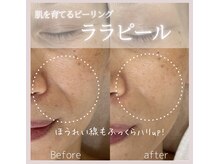 サロン ド ソワン(salon de soin)の雰囲気（ララピールで肌育♪）