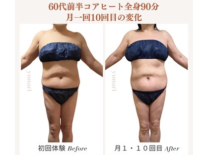 ユナリ(yunari)の写真