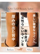 ツキ(TSUKI)/女性らしい美しいライン取り戻す