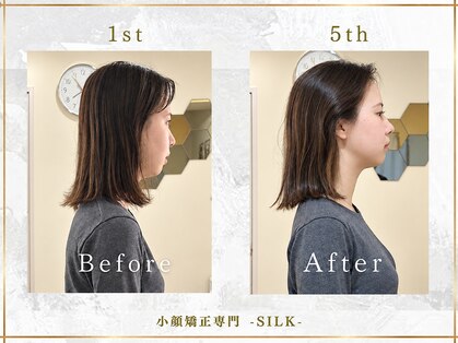 シルク(SILK)の写真