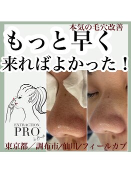 フィールカブ 仙川(feel kab)/毛穴はプロにお任せください♪