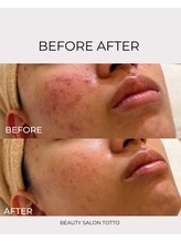 トット 恵比寿(totto)/ケア症例