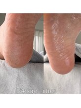 フットミー(foot mii)/