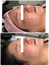 エターナル(Eternal)/横顔もスッキリ