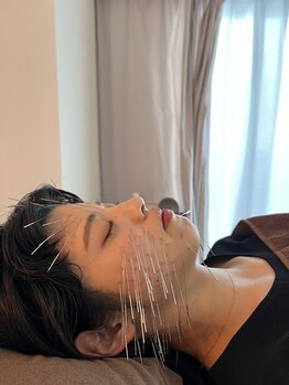 けんたろう鍼灸院/鬼美容鍼