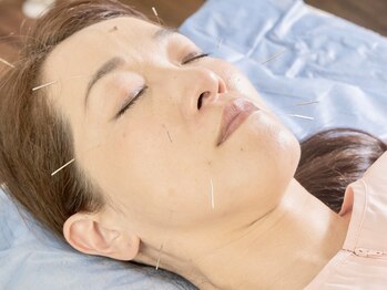 武蔵新城きんとれ治療院/美肌鍼Vela