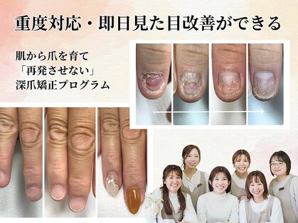 エルナ(elna)の写真