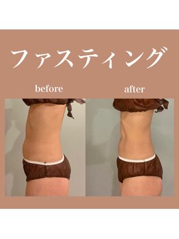 フラットベリー 恵比寿(Flat BELLY)/ファスティング
