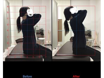 サンテ整体院 宇都宮元今泉(SUNte整体院)/before-after[整体/骨盤矯正]