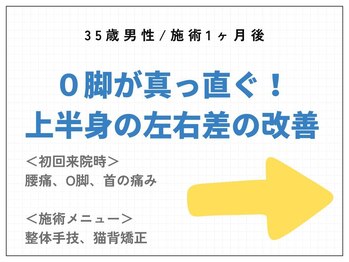 しのまる整体/<グループ院事例>O脚が真っ直ぐ!