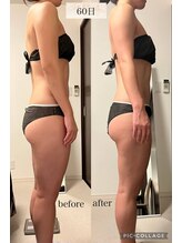 リープ(Lieb)/ブライダル/ビフォーアフター