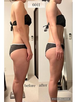 リープ(Lieb)/ブライダル/ビフォーアフター