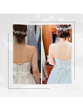 サンテボーテ(Sante Beaute)/ブライダルエステ