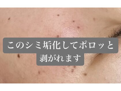 リサロン エヌ(Re salon N)の写真