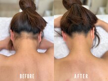 ビーグラム(B.GLAM)/ダブル脱毛／うなじ＋背中