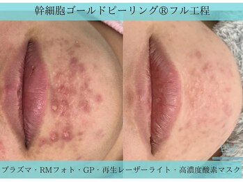 リメイク 広尾(REMAKE)/