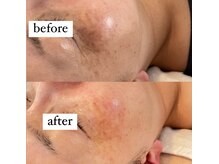 ビューティーネイル(Beauty Nail)の雰囲気(プラズマニア シミ・かんぱん・シワどんなお悩みも改善)