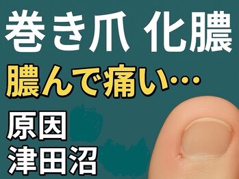 巻き爪じゅん 船橋店/津田沼でできる正しい改善方法