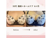 ミミバスト(mimibust)の雰囲気（最新ホームケア取り扱いスタート♪バストアップ/育乳/痩身/千葉）