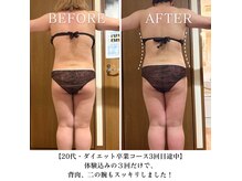 ヨサパーク スリー 西日暮里(YOSA PARK three)の雰囲気（今まで何しても効果がなかった。。。最後のダイエットにしましょ）