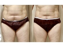 アンヘル(Angel)/軟部組織セラピー♪驚きの変化！