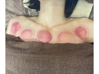 リベル(Liber)/ストレスで睡眠不足が続いてる方