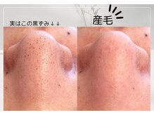 リブレ(LIBRE)/潤艶ワックス脱毛