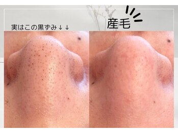 リブレ(LIBRE)/潤艶ワックス脱毛