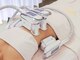 ユアーズビューティー(YOURS beauty)の写真/《#本気で痩せたい方/リバウンドしたくない方》脂肪を分解＆燃焼する、今話題の“脂肪冷却”で美ボディGET!