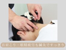よつば治療院の雰囲気（デスクワークや日常生活の肩こり・疲労感も"鍼"でスッキリ感動☆）