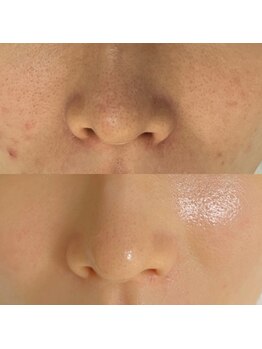 コルザフラワー(charroux flower)/セラピール