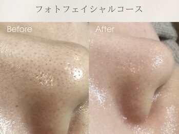 リアン(Rien)/Before/After(1回)