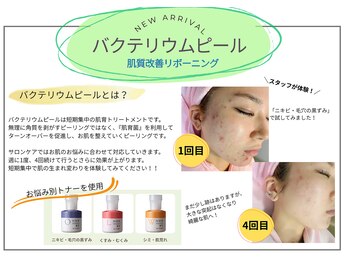 ビューティフェイス ビューティアイラッシュ 岡山天満屋店(BeautyFace Beautyeyelash)/バクテリウムピール【岡山】