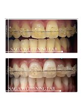 佐賀ホワイトニングラボ/