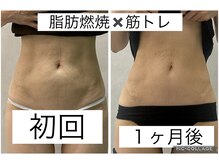 エクラ(Eclat)/Eclatの痩身★before/after17